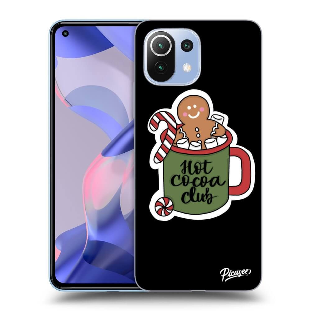 ULTIMATE CASE Für Xiaomi 11 Lite 5G NE - Hot Cocoa Club